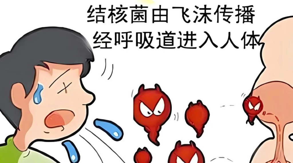 青春不“結(jié)核”：防治結(jié)核，從你我做起！